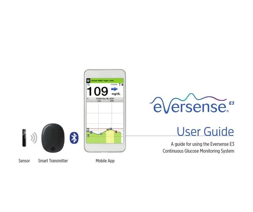 eversense E3 User manual